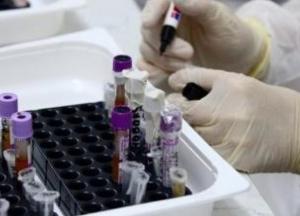 В Украине почти 82 тыс. случаев COVID-19, за сутки - 1 008