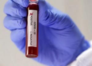 В Днепропетровской области подтвердили первые два случая коронавируса