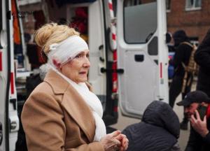 Ракетний удар по Сумах: серед понад 100 постраждалих 23 дитини (відео)