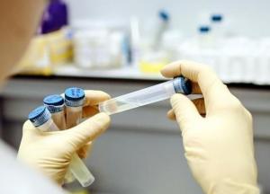 В Украине подтвердили 937 новых COVID-случаев за сутки