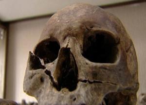 Ученые раскрыли секрет странной аномалии в скелете первобытного человека (фото)