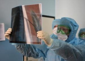 Минздрав обновил условия для лечения COVID-19 в стационаре