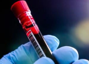 Ученые назвали группу крови, которая обеспечивает самый мощный иммунитет