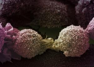 Найдены мутации, вызывающие рак легких