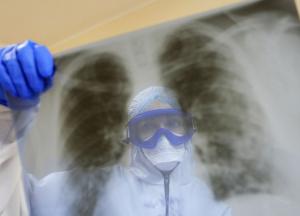 В Минздраве рассказали могут ли вакцинированные от COVID заболеть штаммом "Дельта"