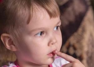 Штамм "Омикрон": медики обнаружили необычный симптом заражения у детей