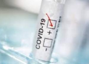 В Украине 2075 новых случаев коронавируса