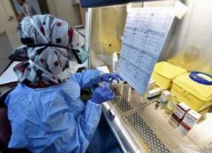 Ученые нашли предотвращающий рак и старение белок