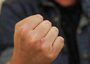 В Киеве мужчину вывезли в лес и ограбили (фото)