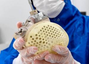 В Европе впервые разрешили продажу искусственного сердца