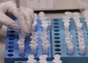 В Украине зафиксирован первый случай коронавируса