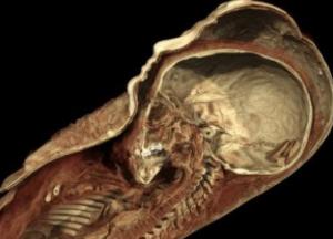 Существо, найденное возле древнейшей пирамиды, оказалось не совсем человеком — археологи