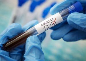 Новые антирекорды: в Украине более 23 тысяч новых случаев COVID-19