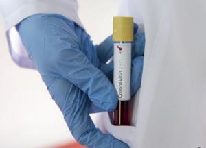 В Италии создали первую в мире вакцину от коронавируса