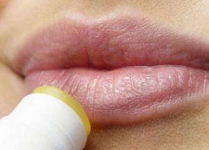 Медики назвали опасные последствия герпеса на губах