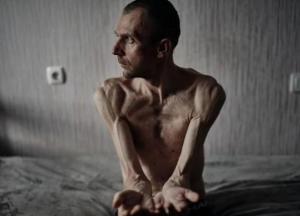 Росія приховує від Червоного Хреста хворих та закатованих українських полонених, – звіт ОБСЄ