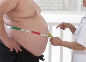 Ученые выяснили, сколько лет жизни крадет у человека ожирение 
