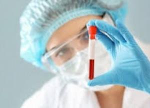 В Украине 10 611 новых случаев коронавируса