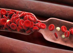 Названы первые признаки образования тромбов в сосудах