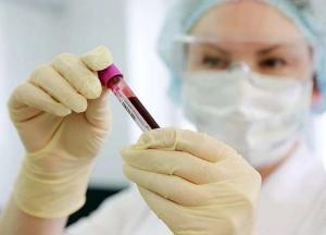 В России число заразившихся коронавирусом приблизилось к сотне