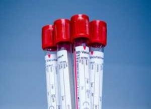 Ученые назвали группу крови, наиболее склонную к агрессивному типу рака