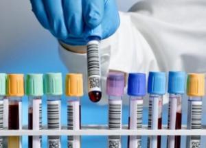 В Украине 13 882 новых случая коронавируса