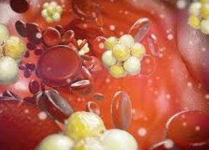 Медики назвали 3 лучших способа избавиться от плохого холестерина