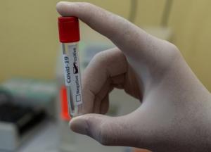 Назван способ избежать тяжелого течения COVID-19