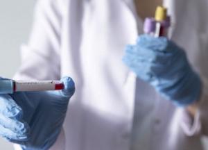 В Украине зафиксирован значительный спад COVID-заболеваемости