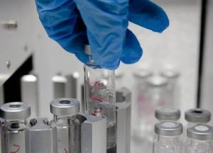 В Киеве женщина похитила из лаборатории опасные штаммы вирусов