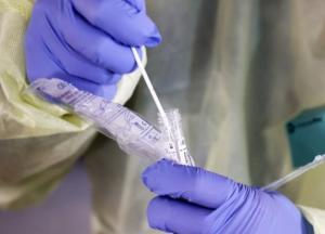 В Украине уже более 2 тысяч случаев COVID-19, из них 69 летальных