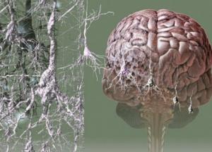 Медик перечислил признаки старческого слабоумия