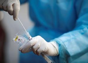 В Украине 8513 новых случаев коронавируса и более 14 тысяч выздоровевших