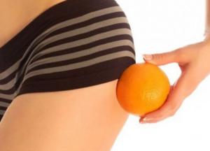 Эти продукты помогут в борьбе с целлюлитом