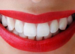 Эффективные средства для отбеливания зубов в домашних условиях