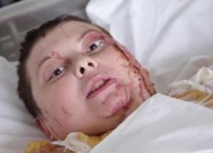 Дело Гандзюк: СБУ говорит о других заказчиках