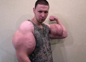 "Руки-базуки" готовится к операции по удалению своих знаменитых бицепсов